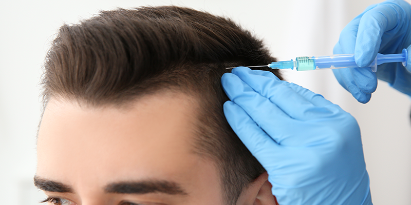PRP Destekli Saç Tedavileri