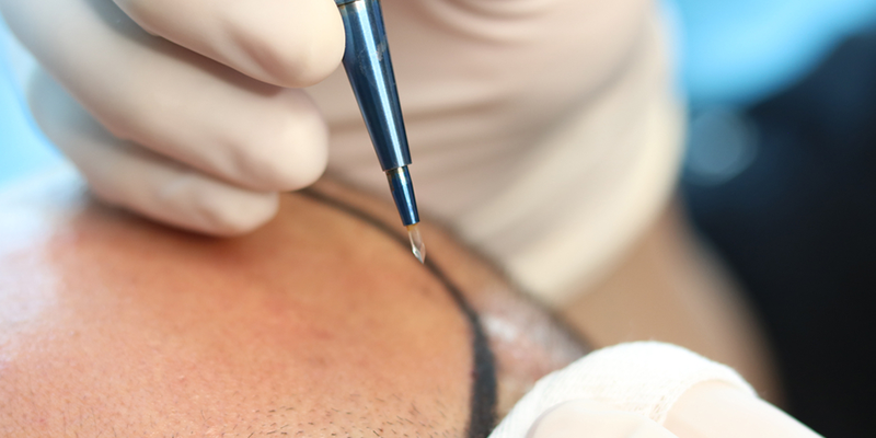 Kalem Tekniği (DHI)