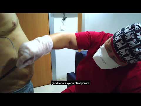 How do we plan before six pack surgery? I Dr.Sevin Özgül