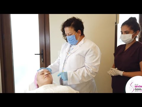 Botox Application   I Dr Sevin Özgül