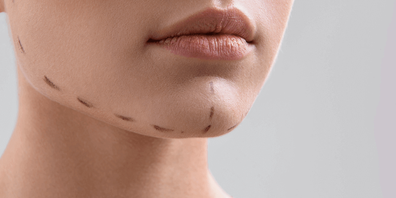 Cheek And Jaw Aesthetics