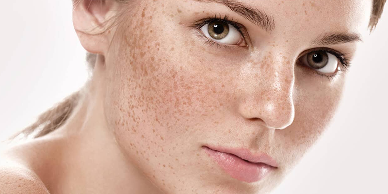 Acne And Scar Treatment