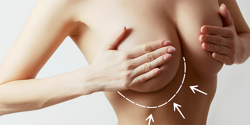 Mammaplasty Enlargement (Breast Augmentatıon)