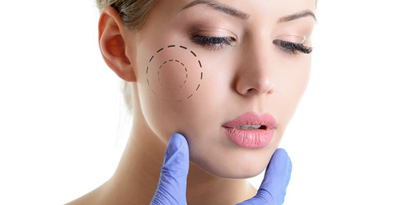 Face And Neck Lift With Thread, Eyebrow Lift
