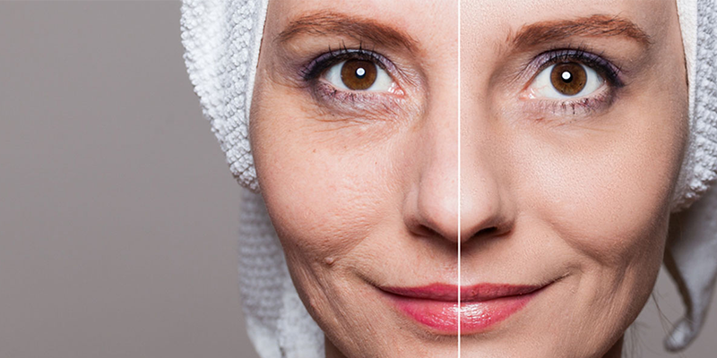 Antı Aging Treatment